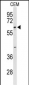 TCHP Antibody (Center)