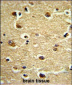 CROT Antibody (N-term)