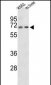 CROT Antibody (N-term)