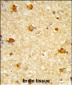 DIRAS1 Antibody (Center)