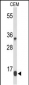 DIRAS1 Antibody (Center)