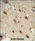 ACP1 Antibody (N-term)