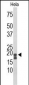 ACP1 Antibody (N-term)