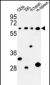 PLCZ1 Antibody (N-term)