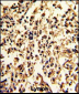 SERPINA9 Antibody (Center)