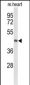 DBC1 Antibody (N-term)