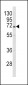 GBE1 Antibody (Center)