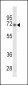 GBE1 Antibody (Center)