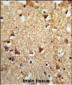 EIF2A Antibody (Center)