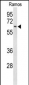 EIF2A Antibody (Center)