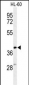 CYTB Antibody (Center)