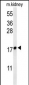 LYPD1 Antibody (C-term)