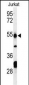 PRUNE Antibody (C-term)