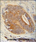 GAGE7 Antibody (C-term)