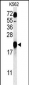 GAGE7 Antibody (C-term)