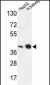 NDUFA10 Antibody (Center)