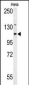 ADCY4 Antibody (Center)