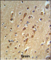 URG4 Antibody (Center)