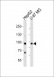 URG4 Antibody (Center)