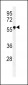 FUT6 Antibody (Center)