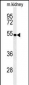 PMPCB Antibody (N-term)