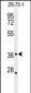 MIIP Antibody (C-term)