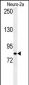 CQ028 Antibody (C-term)