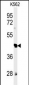 RTN4RL1 Antibody (C-term)