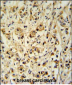 SMAGP Antibody (Center)