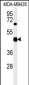 SH2D2A Antibody (Center)