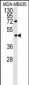 PYHIN1 Antibody (N-term)