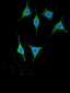 AMY2A Antibody (C-term)