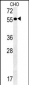 AMY2A Antibody (C-term)