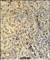 SPT13 Antibody (Center)