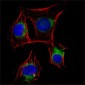 Metadherin Antibody