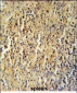 CC106 Antibody  (Center)