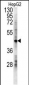 LDHD Antibody (N-term)