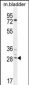 BCA3 Antibody (N-term)