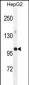 GPAM Antibody (Center)