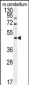 FUS Antibody (C-term)