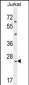 CLDN22 Antibody (Center)