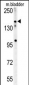 CASZ1 Antibody (C-term)