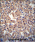 ATPBD3 Antibody (Center)