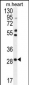 RNF183 Antibody (Center)