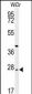 DIRAS3 Antibody