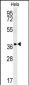 IL24 Antibody (C-term)