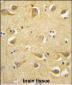 CLTC Antibody (Center)