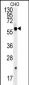 SLC16A9 Antibody (Center)