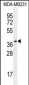 PRSS3 Antibody (N-term)