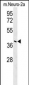 CASC4 Antibody  (C-term)